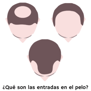 que son las entradas en el pelo