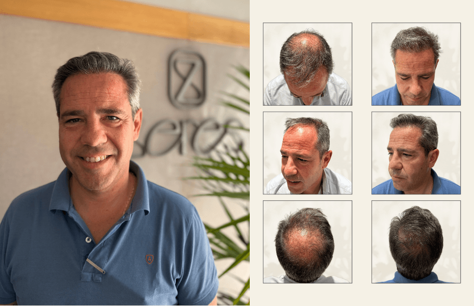 Caso de éxito Raul Mostaza