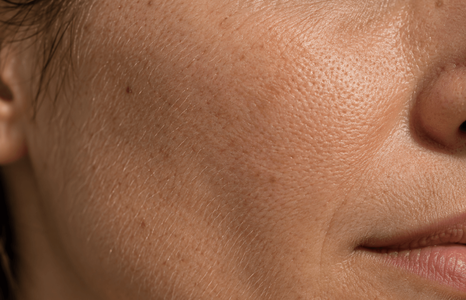 Textura de la piel del rostro: dermatología clínica en Sevilla Textura de la piel del rostro: dermatología clínica en Sevilla